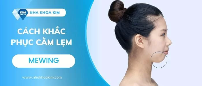 Cằm lẹm là gì? Căm lẹm niềng răng có hết không?