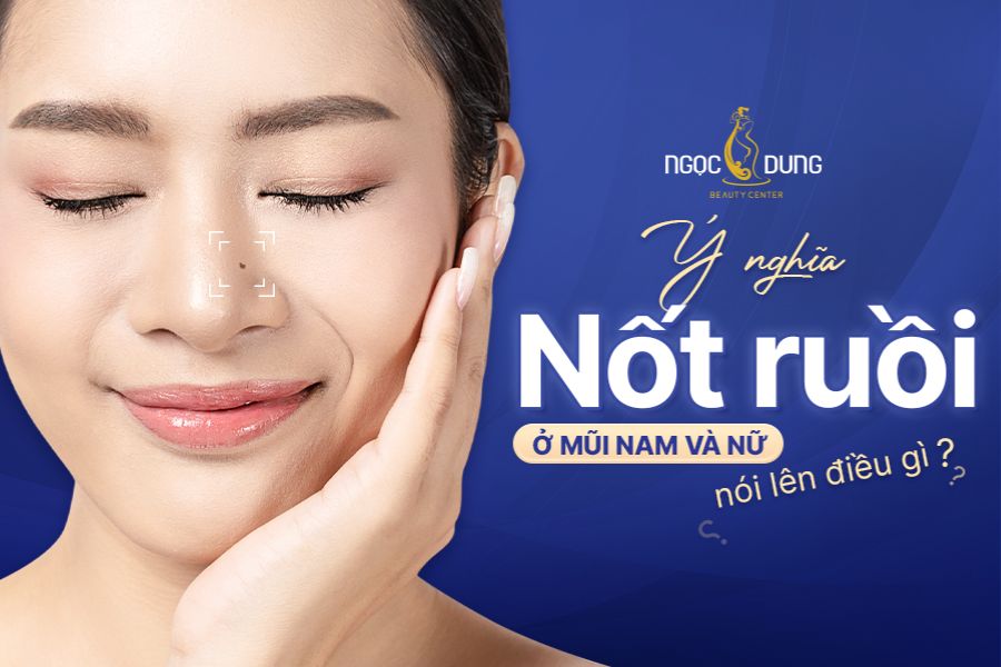 Giải mã ý nghĩa nốt ruồi trên mũi đàn ông và phụ nữ 