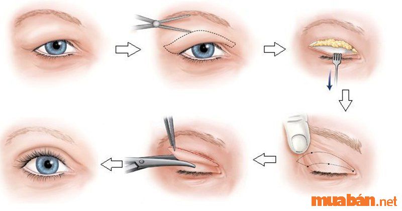 Mắt Bồ Câu Là Gì? Giải Mã Ý Nghĩa Mắt Bồ Câu Trong Nhân Tướng Học