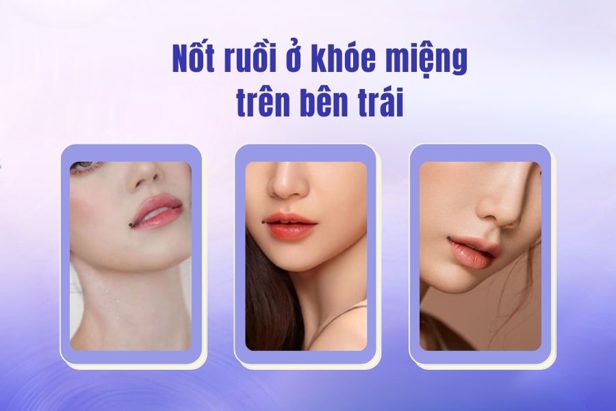 Giả mã nốt ruồi ở miệng tốt hay xấu? Có nên tẩy không?