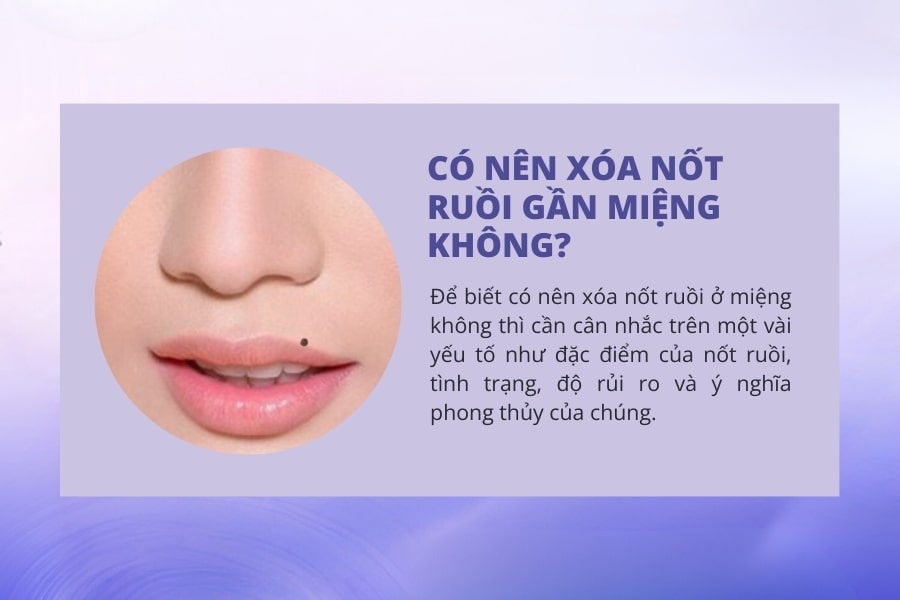 Giả mã nốt ruồi ở miệng tốt hay xấu? Có nên tẩy không?