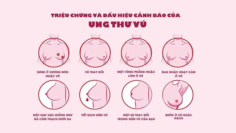 Ngực (vú): Cấu tạo, chức năng và các bệnh lý thường gặp