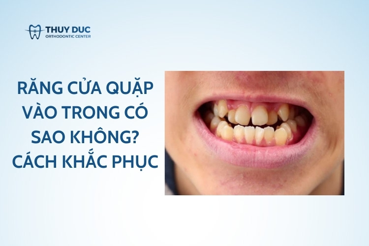 Răng cửa quặp vào trong có sao không? Cách khắc phục