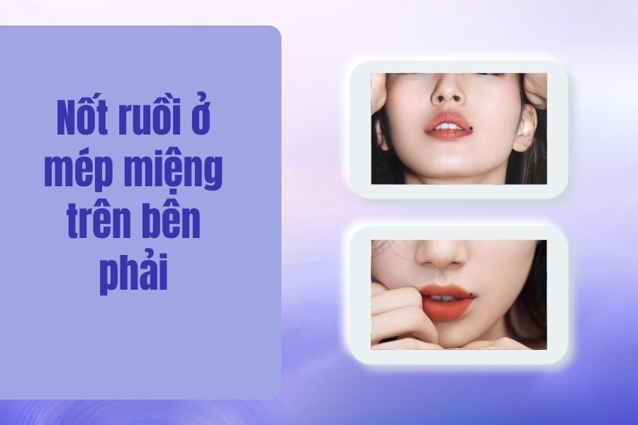 Giả mã nốt ruồi ở miệng tốt hay xấu? Có nên tẩy không?