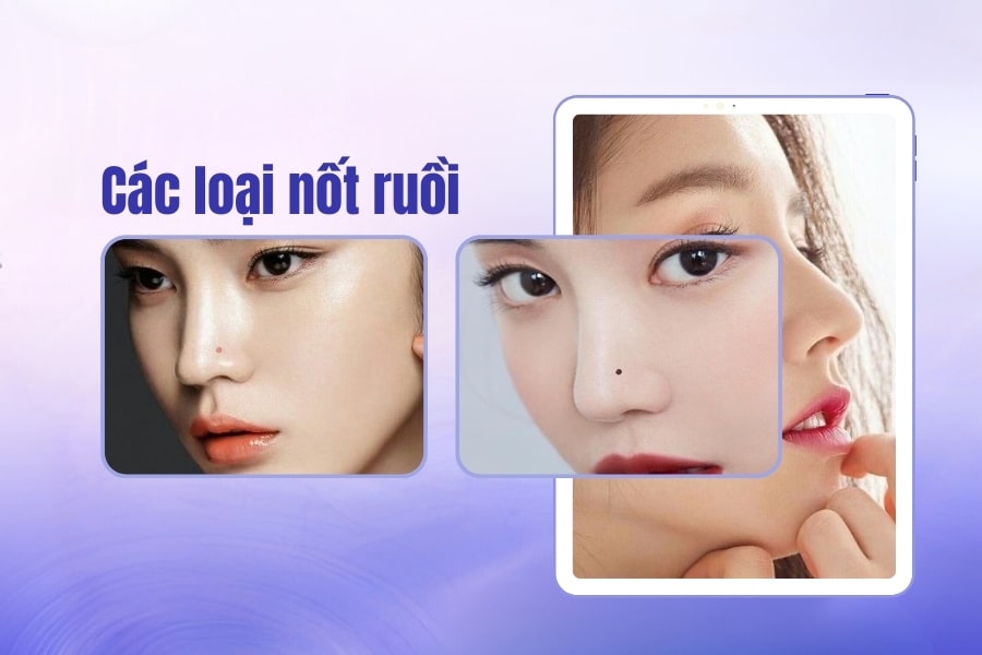 Giải mã ý nghĩa nốt ruồi trên mũi đàn ông và phụ nữ 