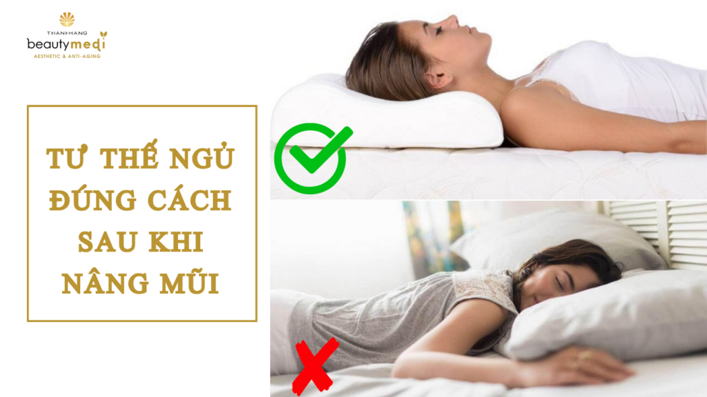 Nâng mũi bao lâu thì được nằm nghiêng? Thời gian kiêng và tư thế nằm 