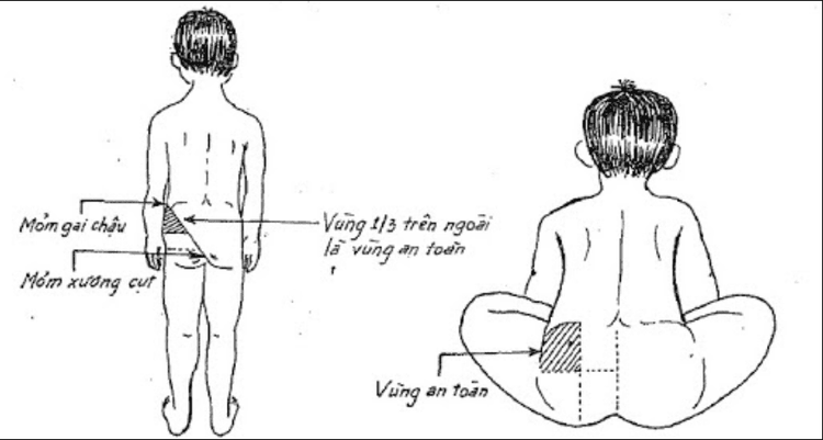 Tại sao phải tiêm mông?