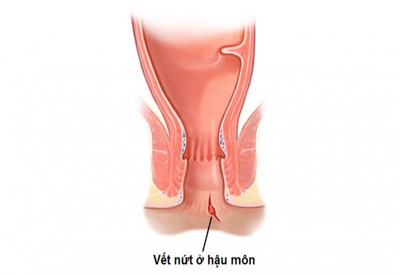 Hậu môn bình thường có cấu tạo như thế nào?