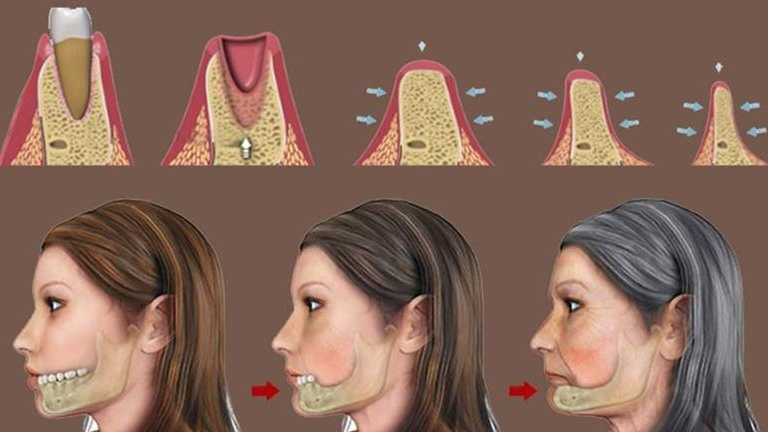 Xương hàm: Cấu tạo, chức năng và một số bệnh lý liên quan