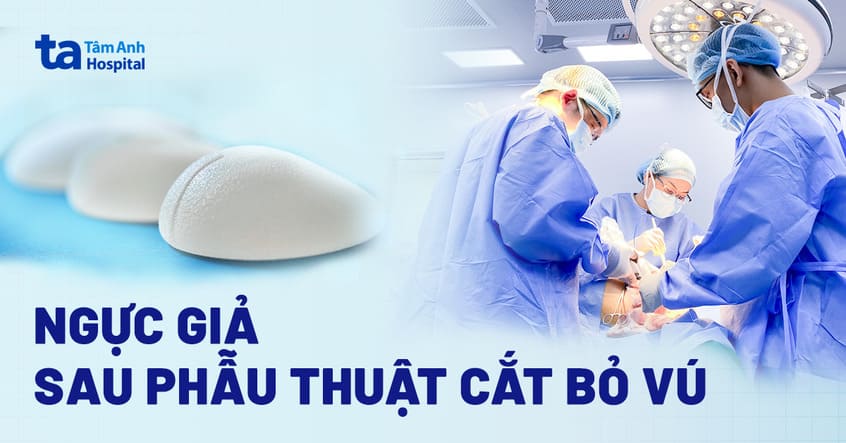 Ngực giả (vú giả) sau phẫu thuật cắt bỏ vú: Hình dạng và chỉ định