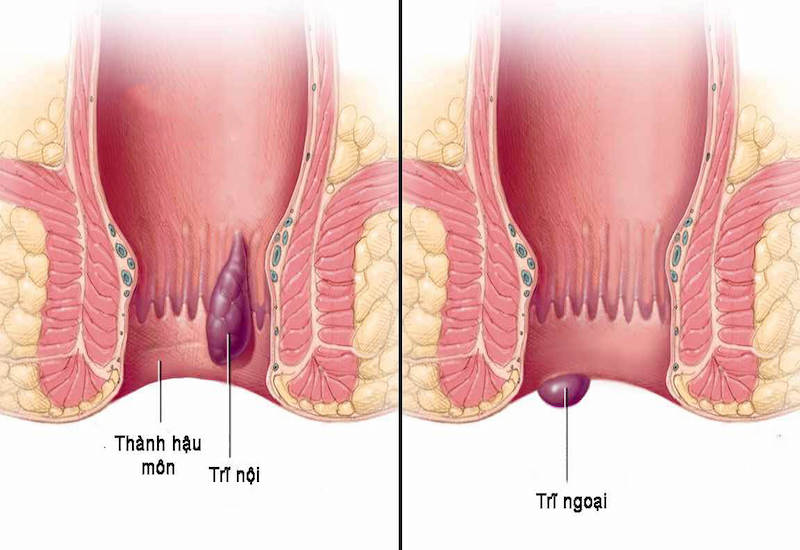 Hậu môn bình thường có cấu tạo như thế nào?