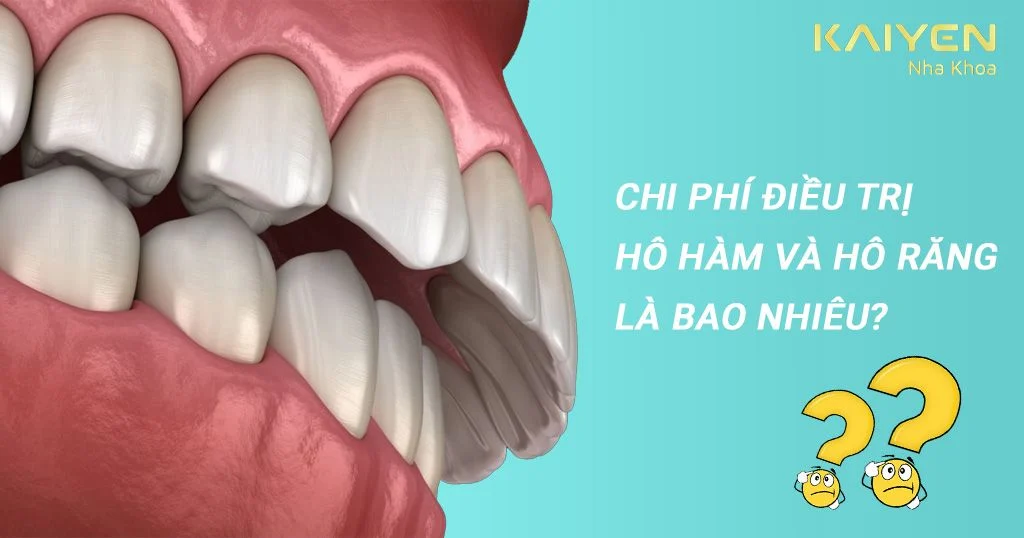 Hô hàm và hô răng: Cách phân biệt và phương pháp điều trị