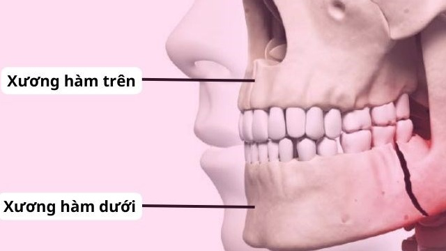 Xương hàm: Cấu tạo, chức năng và một số bệnh lý liên quan